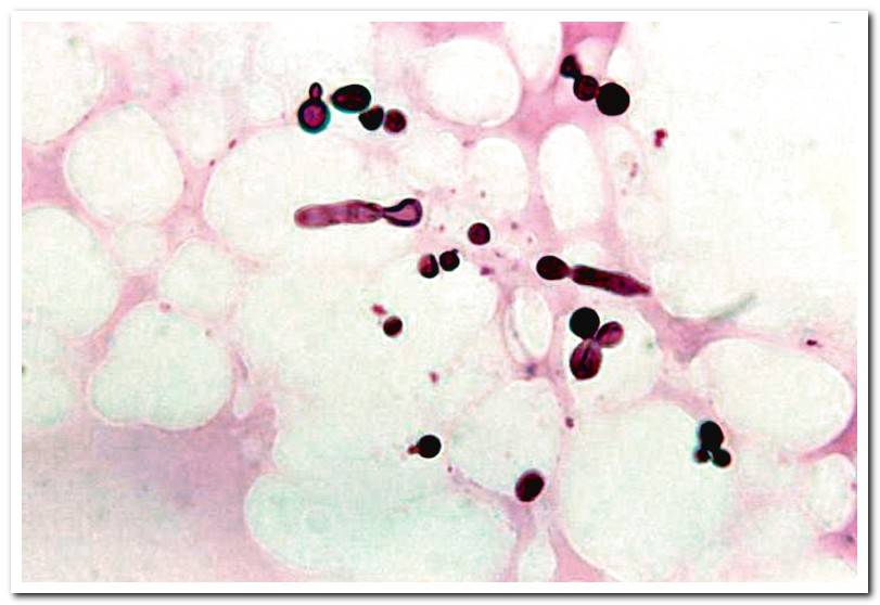 Malassezia-under-the-microscope
