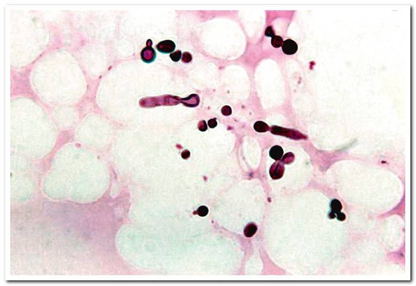Malassezia-under-the-microscope
