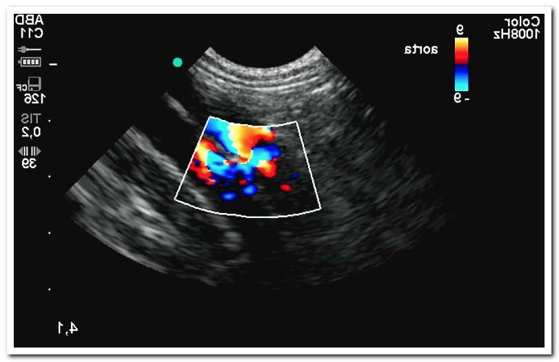 bowel-abdominal ultrasound