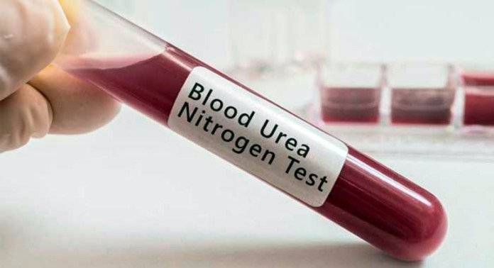 blood-urea-test