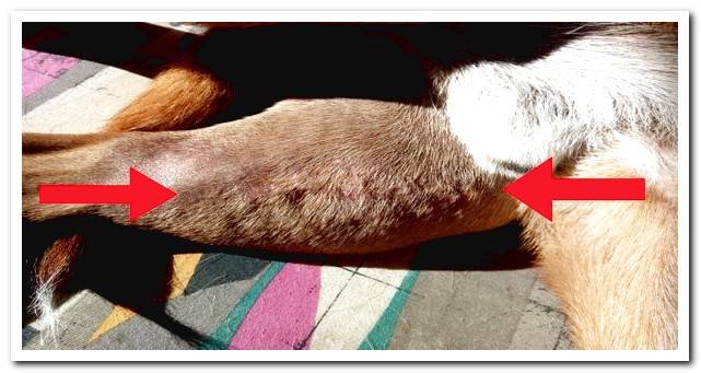 Scar cruciate ligament operation