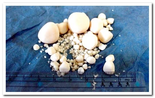 urinary stones